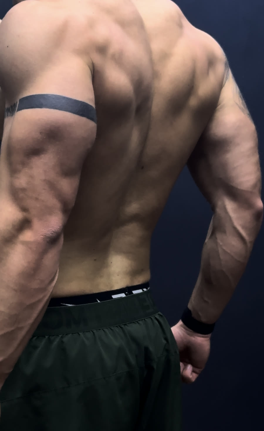 Back and shoulder detail